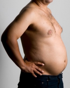 gynecomastie