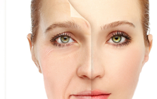 lifting cervico facial tunisie