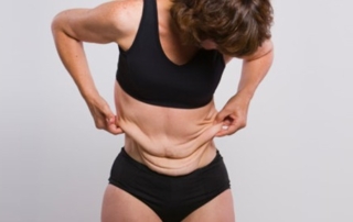 chirurgie peau flasque apres grossesse tunisie
