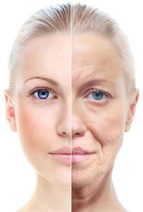 lifting du visage tunisie
