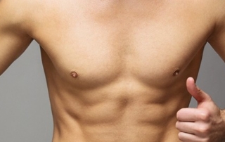gynecomastie tunisie
