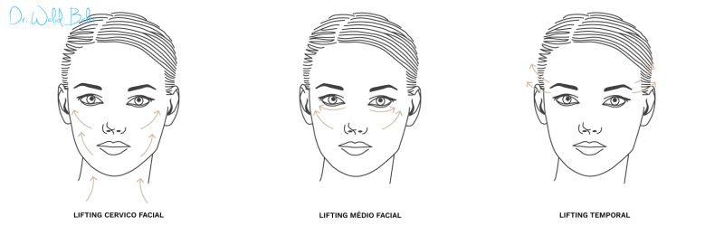 lifting cervico facial tunisie