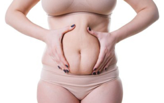 liposuccion abdominoplastie tunisie