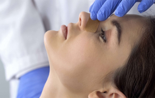 chirurgie esthetique du nez