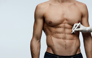 chirurgie esthetique demandees homme