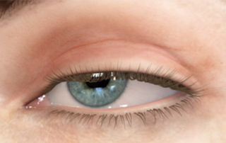 chirurgie ptosis tunisie