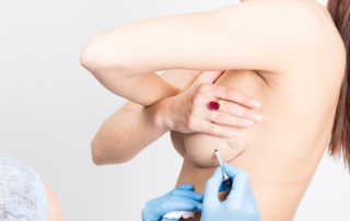 augmentation lifting mammaire tunis