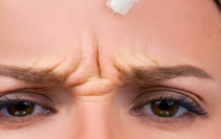 injection botox tunisie