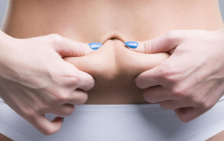 retendre peau chirurgie esthetique tunisie