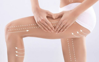 liposuccion jambe tunisie