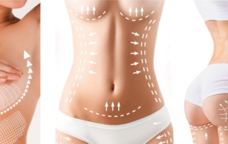 mommy makeover dr balti