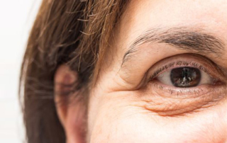 chirurgie poche sous yeux tunisie
