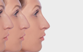 intervention esthetique nez tunisie