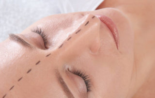 Différence rhinoplastie septoplastie rhinoseptoplastie