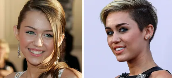 Miley-Cyrus-avant-apres-rhinoplastie