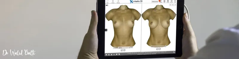 simulation 3d augmentation mammaire tunisie