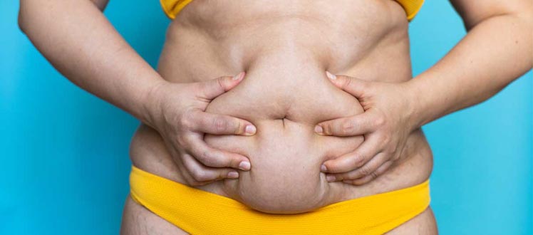 recommandation-avant-abdominoplastie