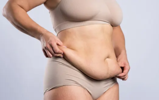 la-chirurgie-abdominoplastie-tunisie