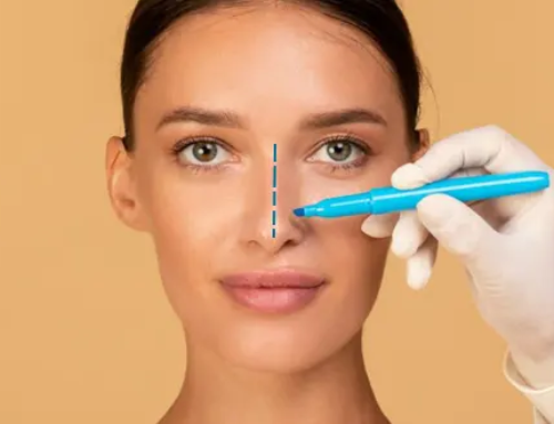 Rhinoplastie de la pointe nasale : que peut-on attendre de ce type de rhinoplastie ?