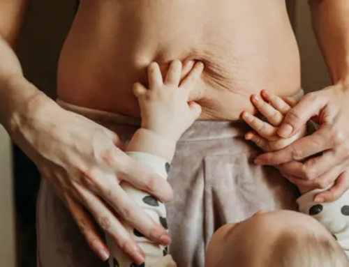 Réparation des muscles droits séparés de l’abdomen (diastasis)