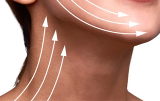 3 Questions au sujet du relâchement du cou et du dessous du menton
