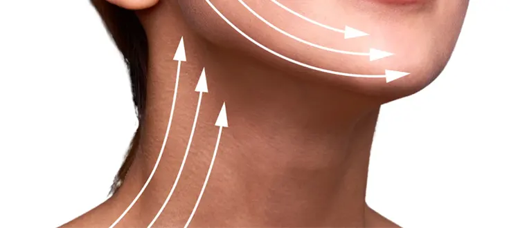 3 Questions au sujet du relâchement du cou et du dessous du menton