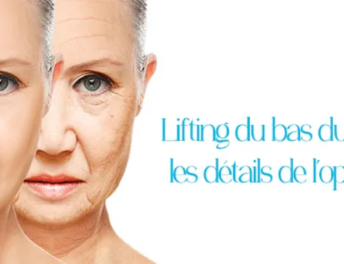 Lifting du bas du visage : les détails de l’opération
