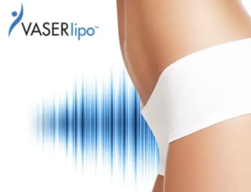Liposuccion Vaser : questions au sujet des zones de traitement