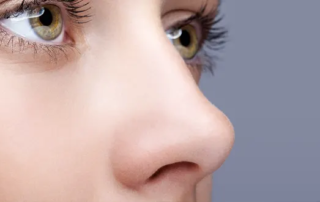 4 points importants au sujet de la rhinoplastie