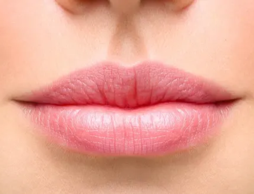Augmentation et remodelage des lèvres : idées reçues et mythes