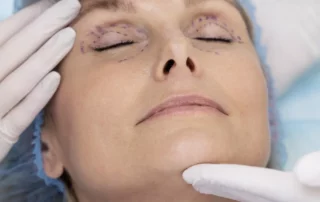 chirurgie esthétique des paupières