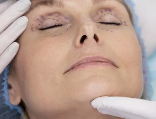 Blépharoplastie : les objectifs des hommes et des femmes
