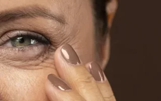 chirurgie poches sous les yeux
