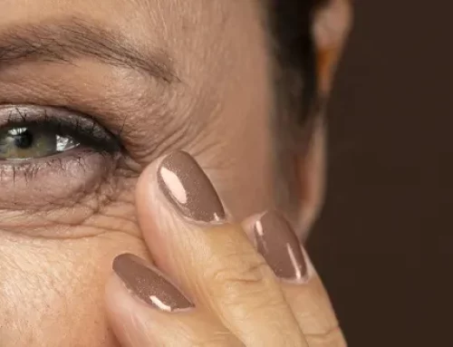 Pourquoi les poches sous les yeux apparaissent-elles ?