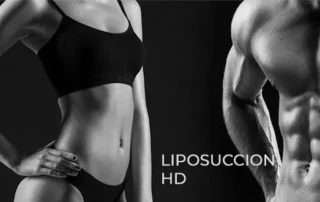 liposuccionhd
