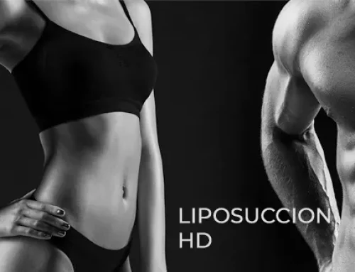 Liposuccion HD : quelles zones du corps peut-on sculpter ?