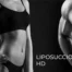 liposuccionhd