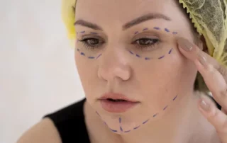 Rajeunissement du visage par transfert de graisse : le rôle des cellules souches graisseuses