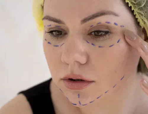Rajeunissement du visage par transfert de graisse : le rôle des cellules souches graisseuses