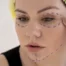 Rajeunissement du visage par transfert de graisse : le rôle des cellules souches graisseuses