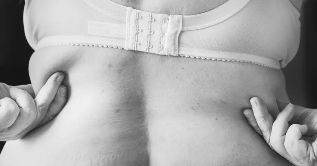 6 faits surprenants au sujet de la graisse humaine