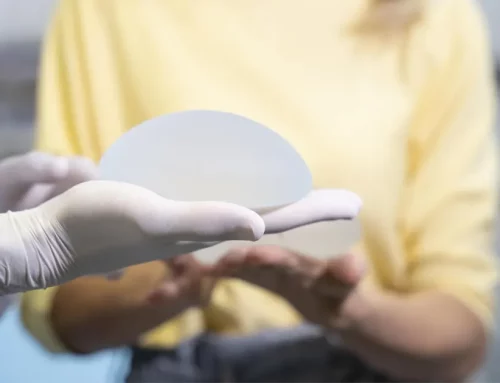 5 idées reçues au sujet des implants mammaires