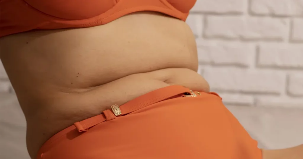 Pourquoi le ventre semble parfois trop gros malgré une silhouette mince