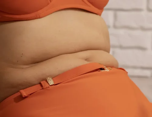 Pourquoi le ventre semble parfois trop gros malgré une silhouette mince ?
